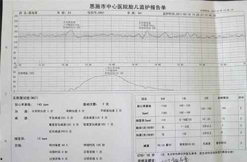 外国产检胎心监护视频,实时监测宝宝健康，揭秘孕期监护新趋势